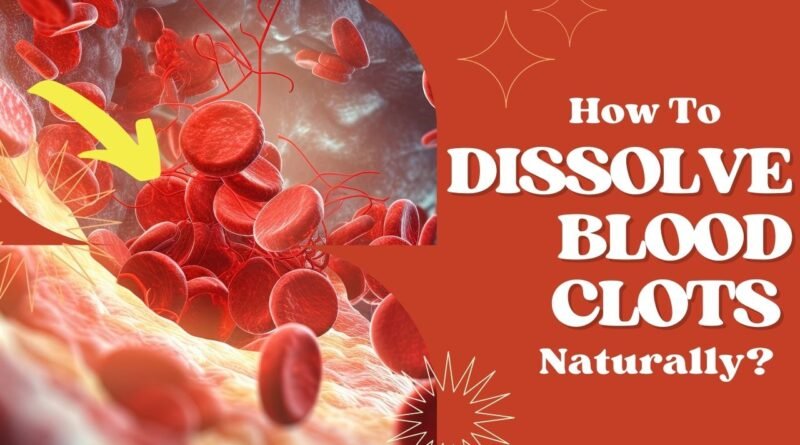 How To DISSOLVE BLOOD CLOTS Naturally