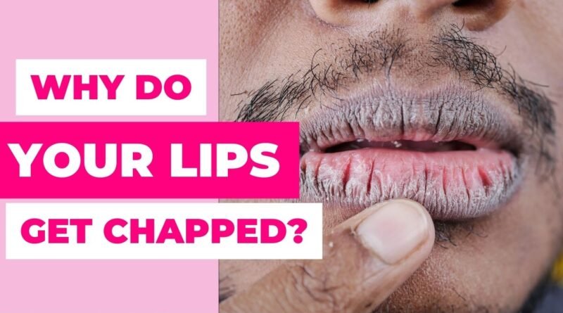 causes of chapped lips