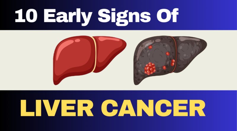 10 Early Signs Of liver cancer